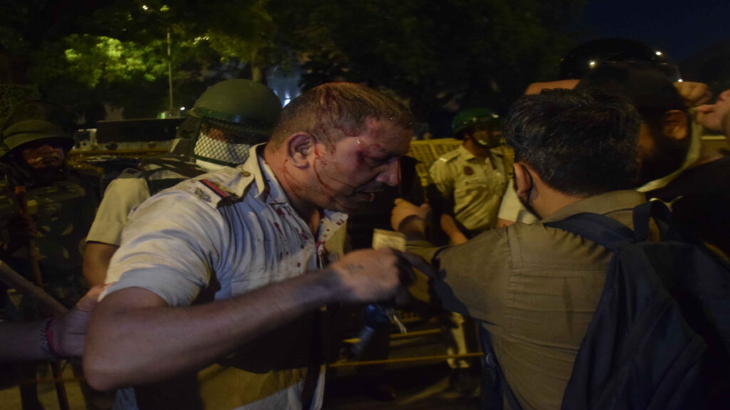 Jantar Mantar Clash : ‘खून से लाल थी वर्दी’, घायल Delhi Police कर्मियों के परिवारों का छलका दर्द