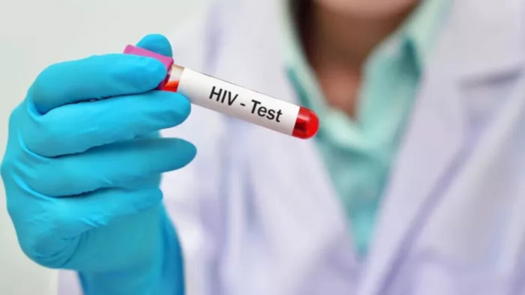 HIV संक्रमितों में बढ़ी नाराजगी, नाम उजागर होने के विरोध में रायपुर में बड़ी बैठक, आंदोलन की रणनीति पर होगा फैसला